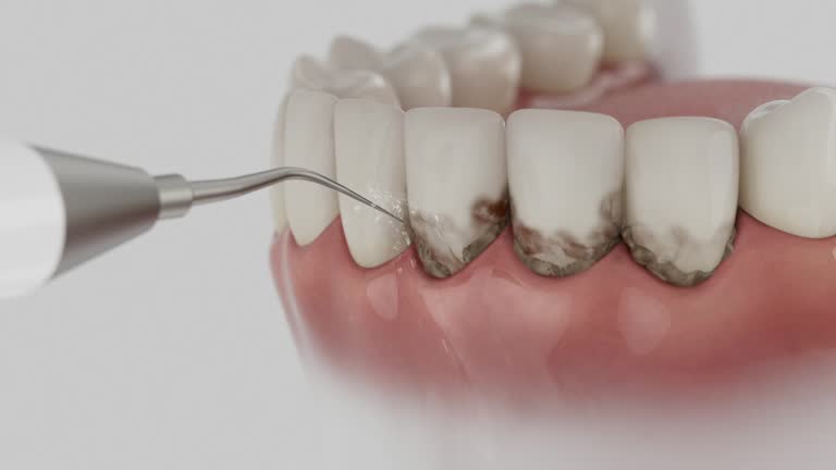 Trusted Wisdom Tooth Removal service in Ponca City, OK - Dentist Open Now